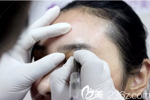 紋眉術(shù)過程中 紋眉術(shù)過程中