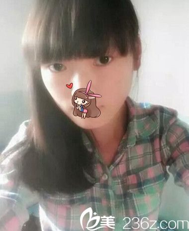 我在新鄉(xiāng)做的雙眼皮經(jīng)歷 我在新鄉(xiāng)做的雙眼皮經(jīng)歷