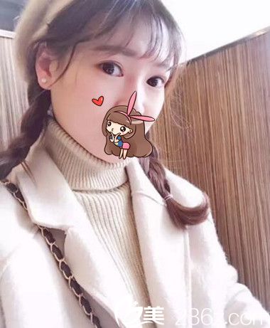 姐姐陪我來整形割了雙眼皮還開了眼角 從此告別老氣難看吊梢眼