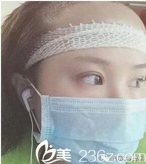 移植后兩天效果