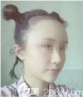 種植后三天效果