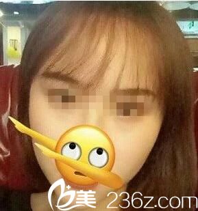 大腦門有救了！只需像她一樣去類似于武漢天申這樣的醫(yī)院做個(gè)發(fā)際線移植