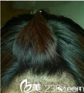 種植后一個(gè)月效果