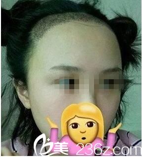 種植后一周效果