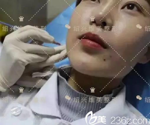 紹興維美注射瘦臉過程 紹興維美注射瘦臉過程