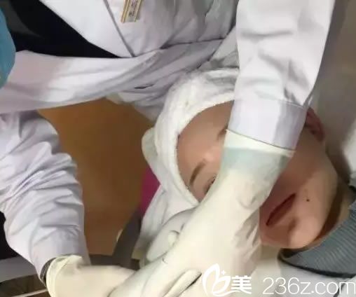 紹興維美激光祛斑過程 紹興維美激光祛斑過程