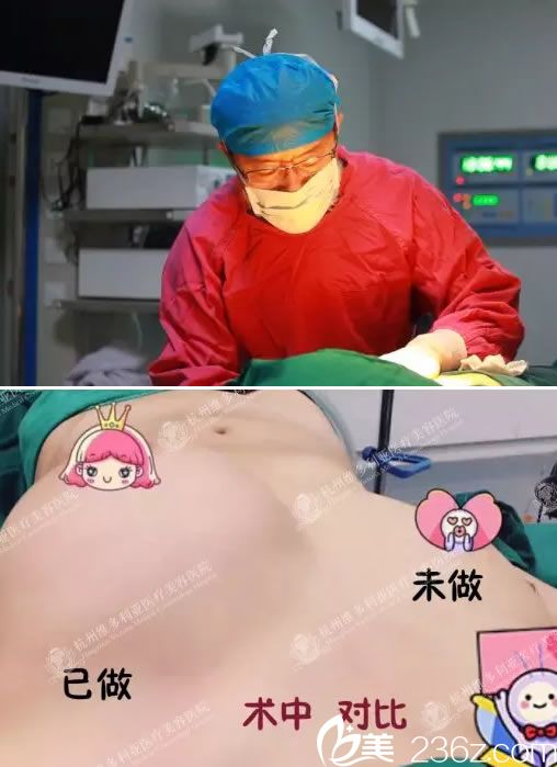 維多利亞劉中策自體脂肪隆胸過程 維多利亞劉中策自體脂肪隆胸過程