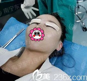 在南寧東方做雙眼皮手術(shù)后包扎 在南寧東方做雙眼皮手術(shù)后包扎