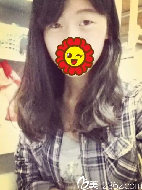 讀書時候的單眼皮照片 讀書時候的單眼皮照片