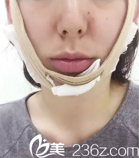 帶著繃帶的樣子 帶著繃帶的樣子