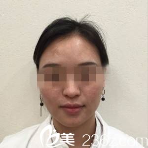 手術(shù)前的我 手術(shù)前的我