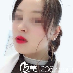 術(shù)后20天 術(shù)后20天