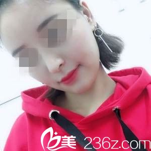 術(shù)后一個月 術(shù)后一個月