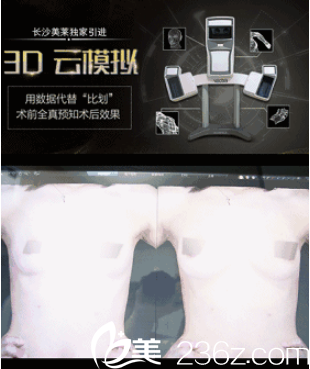 長(zhǎng)沙美萊3D云模擬整形儀 長(zhǎng)沙美萊3D云模擬整形儀