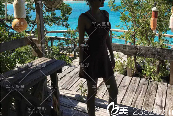 <!--<i data=20240703-sp></i>-->吸脂豐胸術(shù)后美照 <!--<i data=20240703-sp></i>-->吸脂豐胸術(shù)后美照