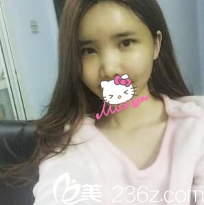 術(shù)后第五天 術(shù)后第五天