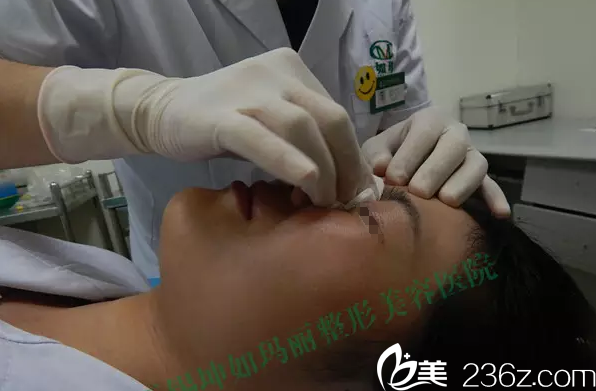 玻尿酸的塑形過(guò)程 玻尿酸的塑形過(guò)程