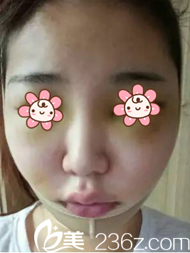 樸正日院長(zhǎng)剛給我手術(shù)完 樸正日院長(zhǎng)剛給我手術(shù)完