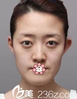 我決定去重慶美侖美奐整形前那時 我決定去重慶美侖美奐整形前那時