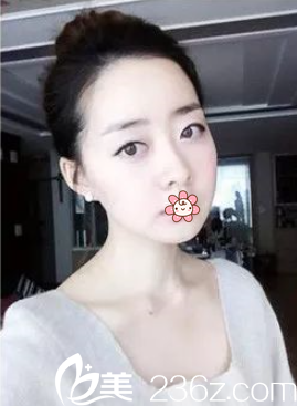 術后兩個月 術后兩個月