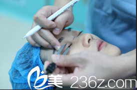 北京藝星雙眼皮術(shù)前設(shè)計(jì)照 北京藝星雙眼皮術(shù)前設(shè)計(jì)照