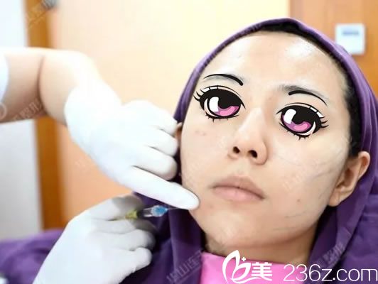 連天美注射玻尿酸填充過程 連天美注射玻尿酸填充過程
