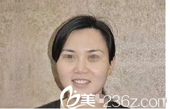 王者之心光子嫩膚的效果真的有那么好嗎?在常州博仕體驗過后皮膚水嫩嫩