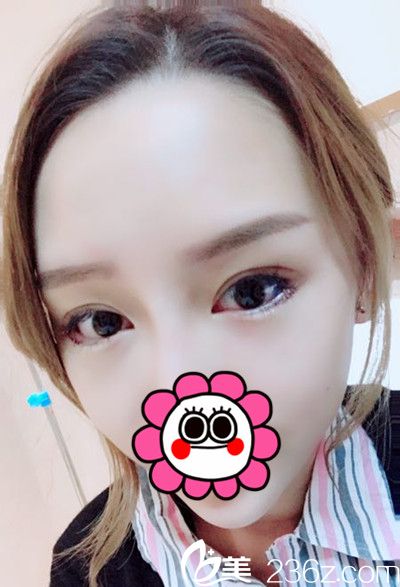 <!--<i data=20240703-sp></i>-->下眼瞼下至手術(shù)當(dāng)天