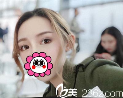 <!--<i data=20240703-sp></i>-->下眼瞼下至手術(shù)后9天