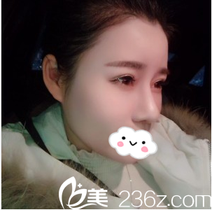 術(shù)后第20天 術(shù)后第20天