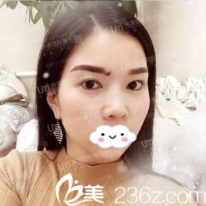 回顧我不開(kāi)刀祛眼袋的心路歷程，為曾祥宏醫(yī)生的技術(shù)點(diǎn)贊