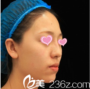 韓國(guó)Stanley皮膚科李恩碩案例 韓國(guó)Stanley皮膚科李恩碩案例