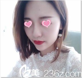 李恩碩注射7天效果 李恩碩注射7天效果