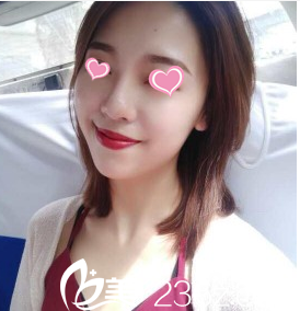 韓國(guó)Stanley皮膚科治療后17天樣子 韓國(guó)Stanley皮膚科治療后17天樣子