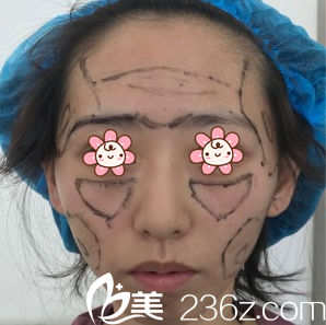 朱紅振醫(yī)生給我面診 朱紅振醫(yī)生給我面診