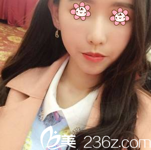 重慶聯(lián)合麗格面部填充術(shù)后11天 重慶聯(lián)合麗格面部填充術(shù)后11天