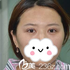 手術(shù)當(dāng)天 手術(shù)當(dāng)天