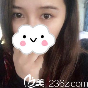 術(shù)后第22天 術(shù)后第22天