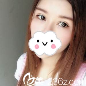 割雙眼皮，我選岳陽紐尚陽光醫(yī)療美容醫(yī)院，一個月恢復(fù)全過程記錄