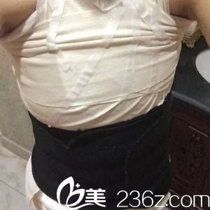 手術當天 手術當天