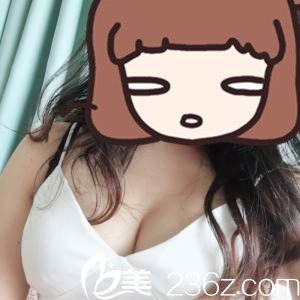 手術后第20天 手術后第20天