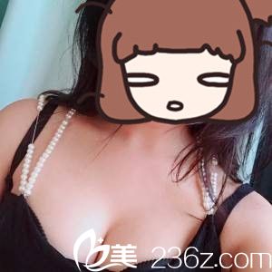婁底德美陳貴南醫(yī)生給我做的自體脂肪豐胸，順便也為我瘦了身，真是兩全其美 ，一次到位啊