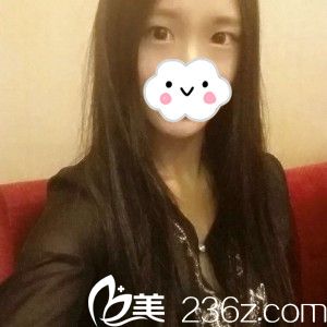 單眼皮的我 單眼皮的我