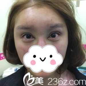 術(shù)后當(dāng)天 術(shù)后當(dāng)天