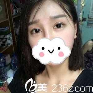 術(shù)后半個(gè)月 術(shù)后半個(gè)月