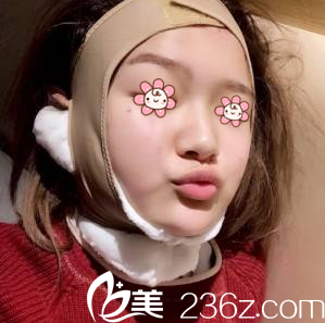 才俊明醫(yī)生給我術(shù)后第三天 才俊明醫(yī)生給我術(shù)后第三天