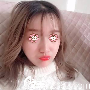 一周拆線 一周拆線