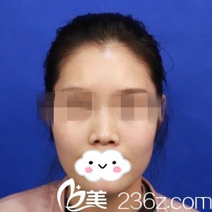 手術(shù)前的我 手術(shù)前的我