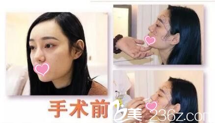 陳院長術(shù)前面診設計畫線