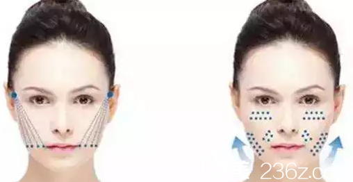 大同美神面部線雕提升圖